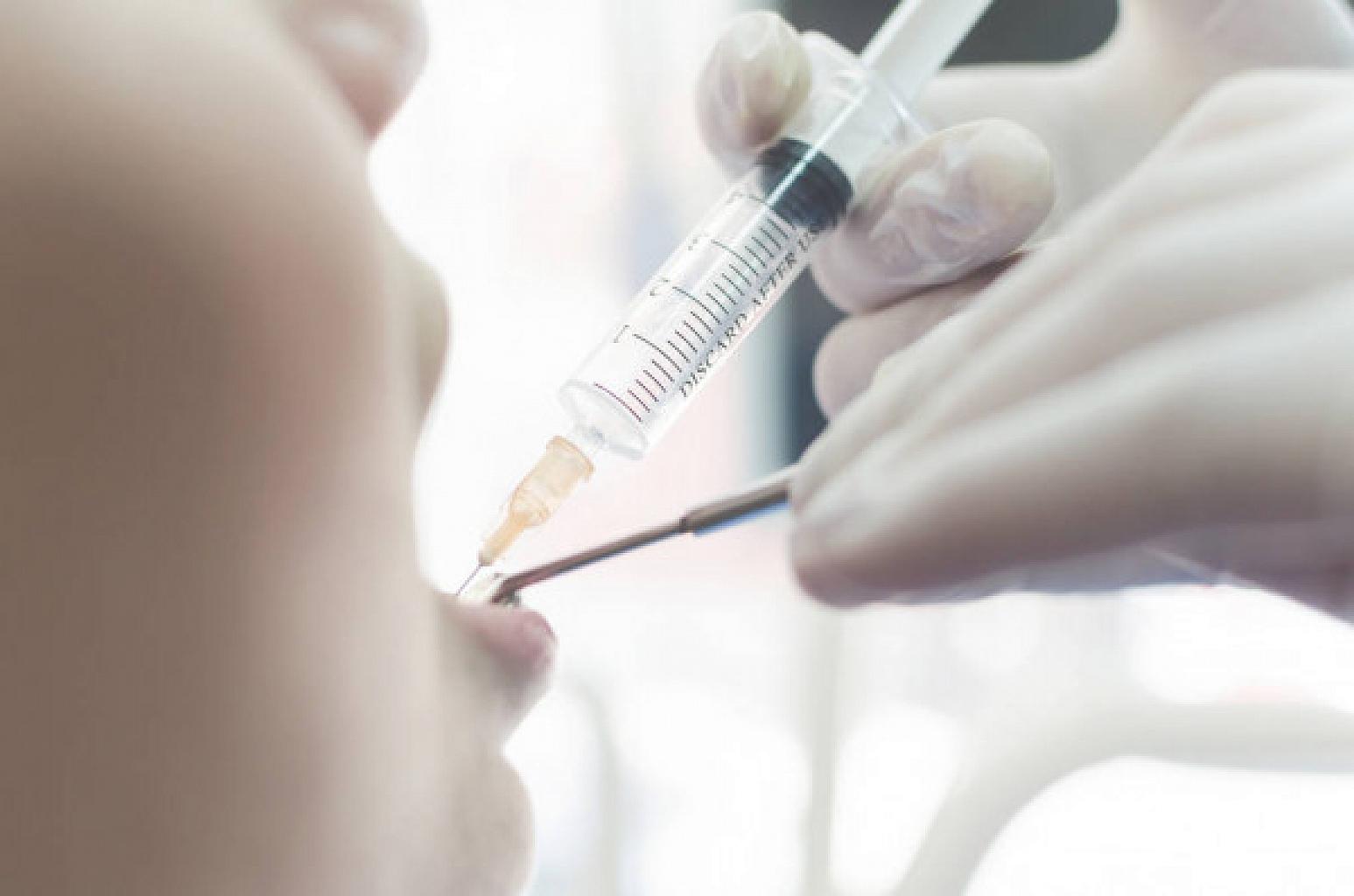 Виды анестезии в стоматологии