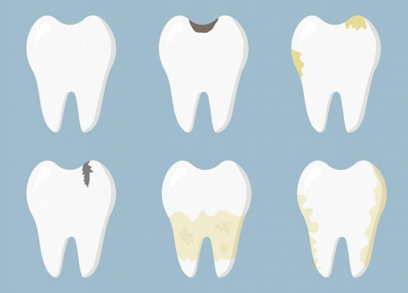 Заболевания пародонта и их лечение