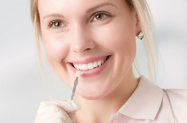 Виниры <br> ВНИМАНИЕ АКЦИЯ 25 000 руб.