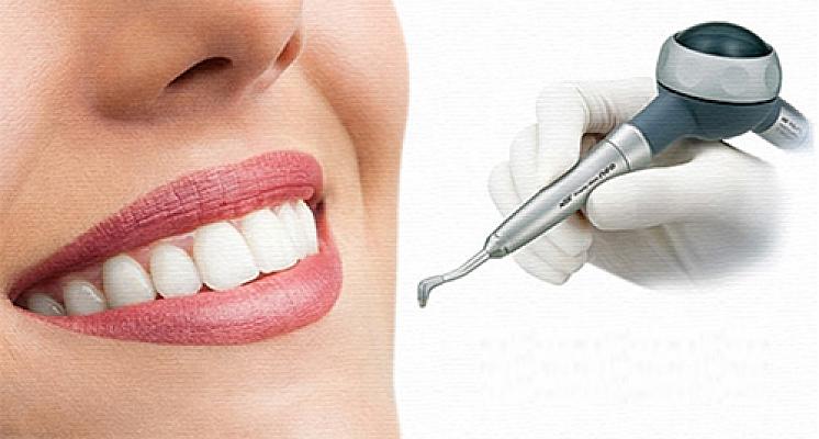 Чистка Air Flow и ультразвук